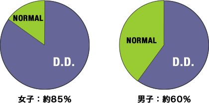 関節円板の転位