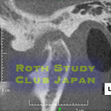 スプリント治療前